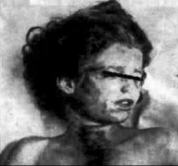 mary-phagan-autopsy-photo-1913